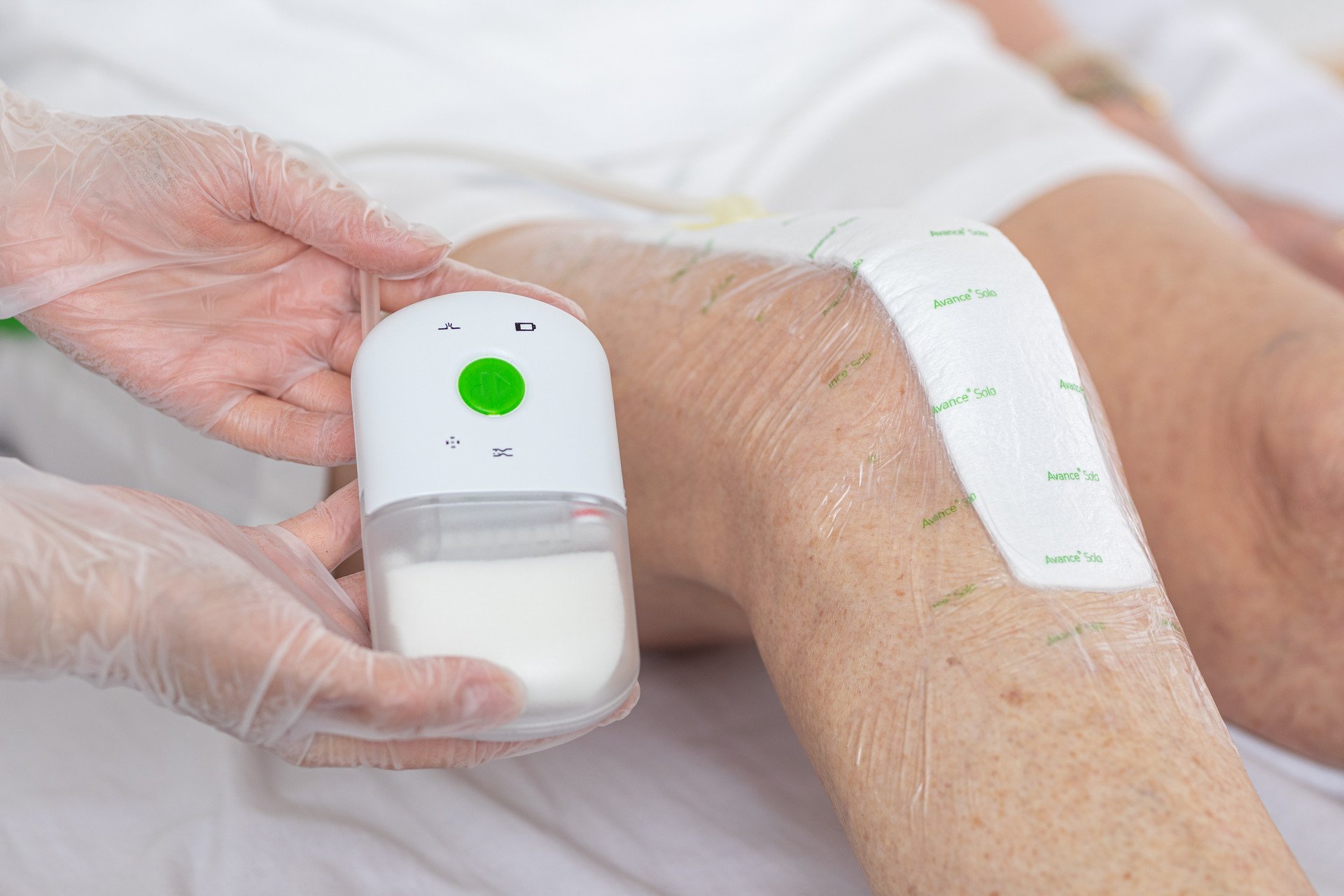 Terapia a pressione negativa: cos’è, vantaggi e come funziona